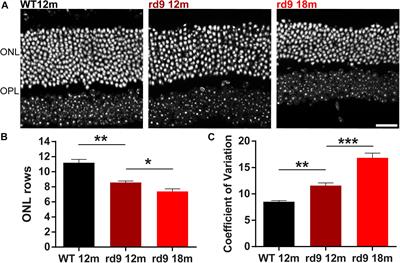 Retinal Phenotype in the rd9 Mutant Mouse, a Model of X-Linked RP